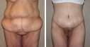 Before & After Photos